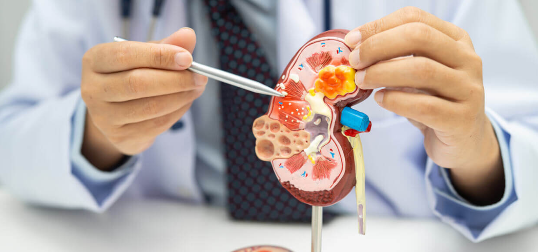 Nephrology Services in Ahmedabad