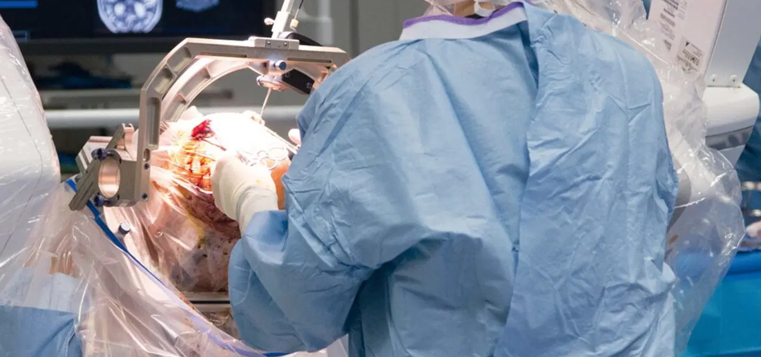 Neuro Surgery Services in Ahmedabad